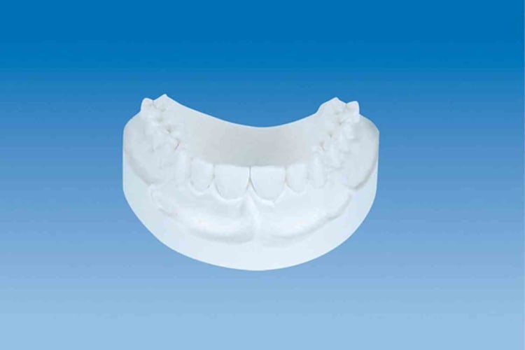 KFO-Gips brillant-weiß 25Kg