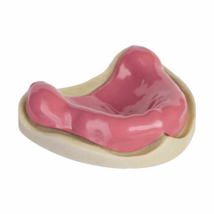 Drufoplast 120x2,0mm rosa 15St