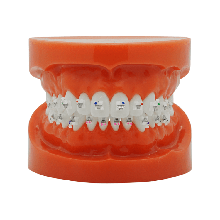 Ceramic SL Selbstligierend (MBT)