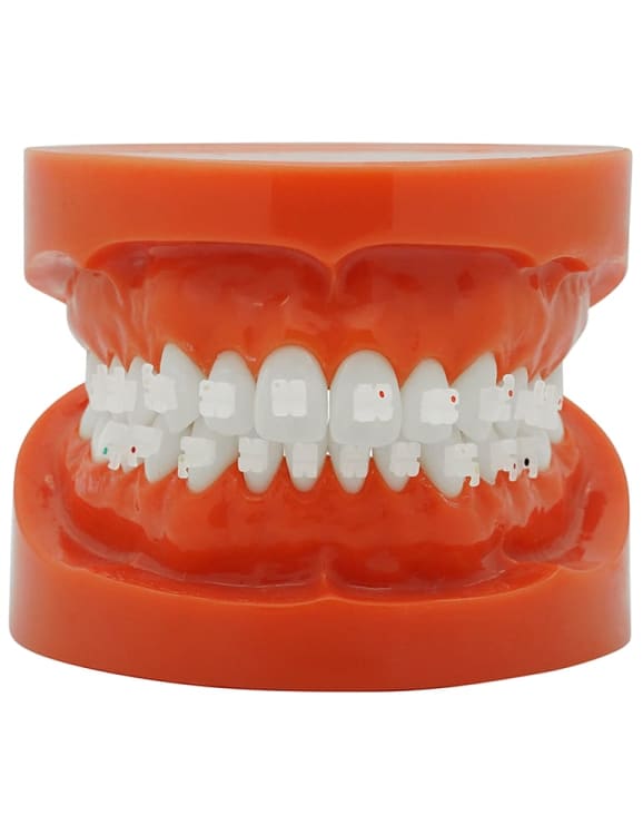 Mini Keramik Bracket (Roth)