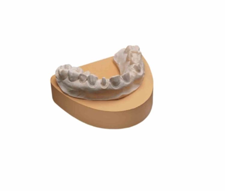 Flowstone gelb Typ4 15Kg