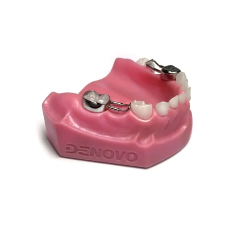 Denovo demonstration model