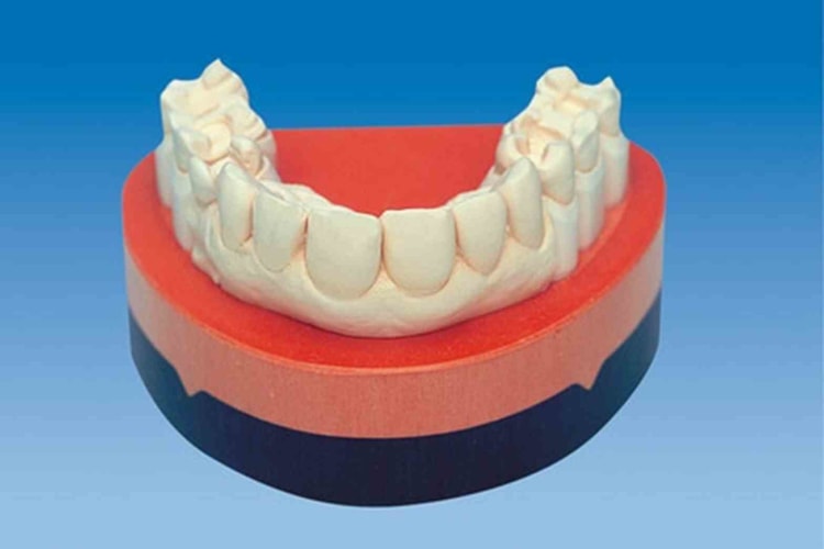 Picodent Z260V Mandarijn 18 kg