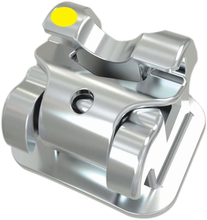 Oppa aktives selbstligierendes Bracket 5-5 Kit, .022 MBT, mit Häkchen auf 3 4 5