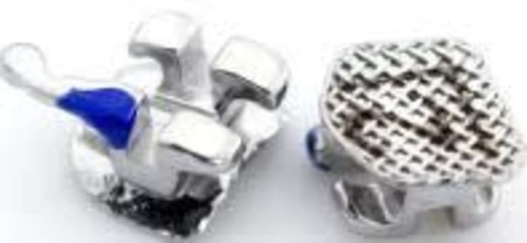 MIM Mini Metal Bracket Roth .018" 44
