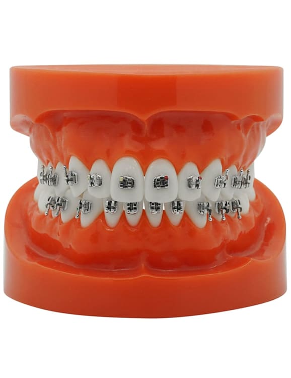 Laser Mini Bracket (MBT)