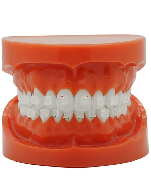 Saphir Bracket (Roth)