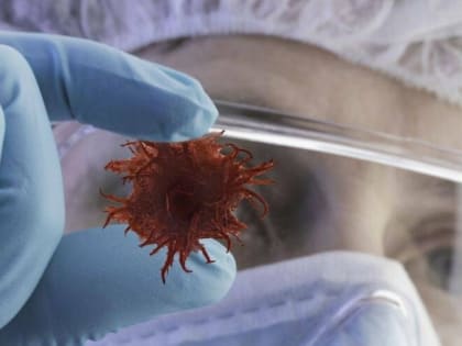 В Северной Осетии больных раком  стало больше на 8%