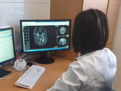 Более 26 тыс исследований заболевания грудной клетки провел ИИ для постановки диагноза в Северной Осетии