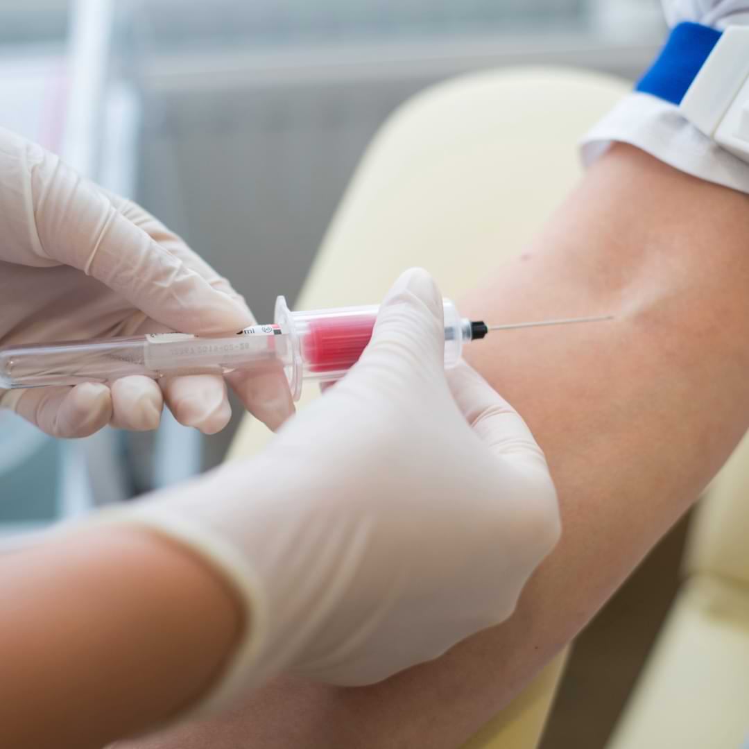 Blood tests and CEA