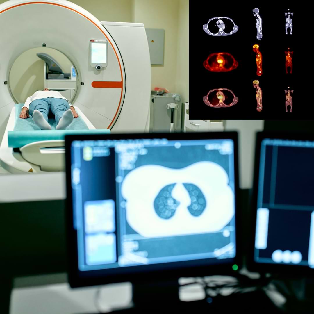 CT or PET-CT scan