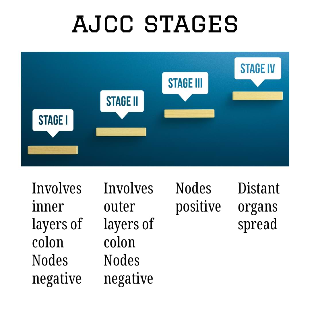Colon cancer stages