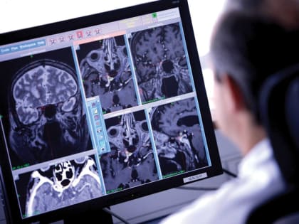 Новый аппарат МРТ в Воркуте улучшит качество медицинской помощи