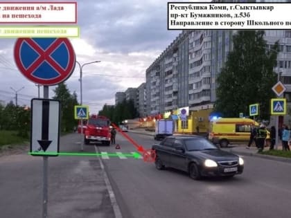 В Сыктывкаре на пешеходном переходе сбили ребёнка на самокате