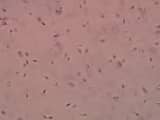 How Egg ‘Glue’ Safeguards Chromosome Links and Could Revolutionize Age‑Related Infertility