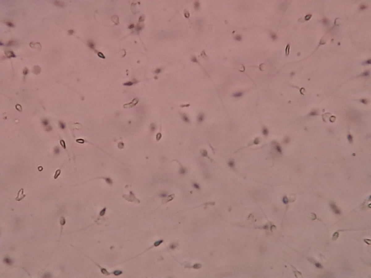 How Egg ‘Glue’ Safeguards Chromosome Links and Could Revolutionize Age‑Related Infertility