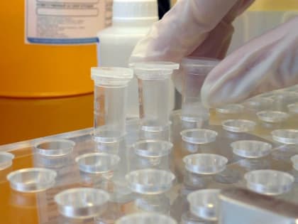 Кузбасские специалисты рассказали, кому нужно сдавать анализ на гепатит С