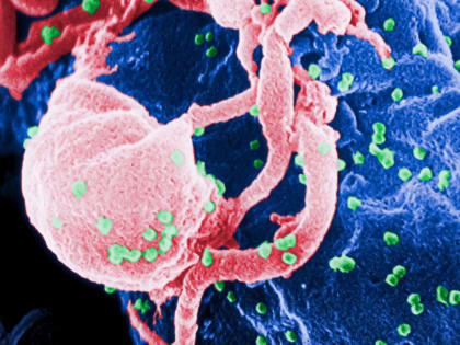 ВИЧ не спрячется: найден способ полностью уничтожить вирус без вреда для организма