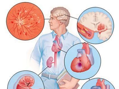 Всемирный день борьбы с артериальной гипертензией