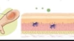 Immunology Lecture 16 - Type IV Hypersensitivity Reactions