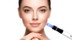 Microneedling Scars Wrinkles Hair Growth & DeepChemical Peel
