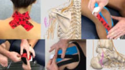 Kinesiology Taping - A Cutaneous Nervous System Approach