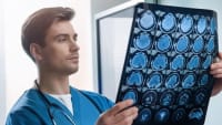 NCLEX Simplified: Neurology, Senses, and GI