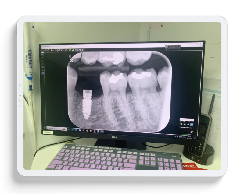 wiftdental-stallion-plus-create-track-orders