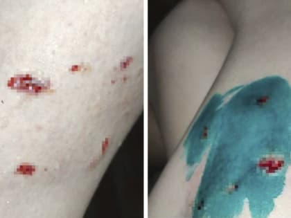 В Свободном женщину покусали бездомные собаки