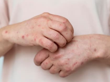 Четверых амурчан, которые могут быть заражены вирусом, взяли под контроль