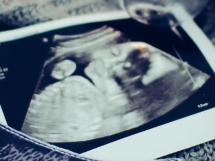 Обязательная беседа с психологом и прослушивание сердцебиения: Минздрав обновил клинические рекомендации для абортов