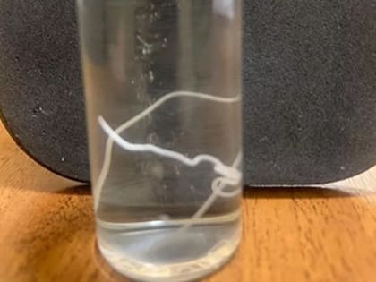 В голове жителя Новороссийска после укуса комара завелся огромный червь