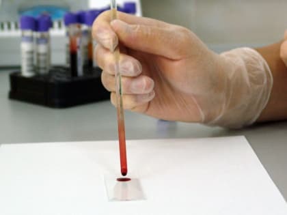 Эпидемическая ситуация в Амурской области: последние данные