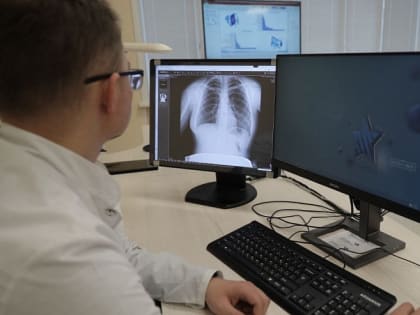 Акция по обследованию легких в Архангельской области