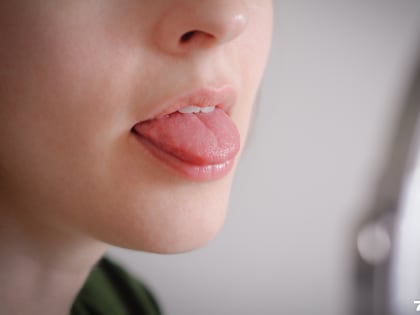 Диабет, инсульт, рак: 15 болезней, о которых расскажет ваш язык