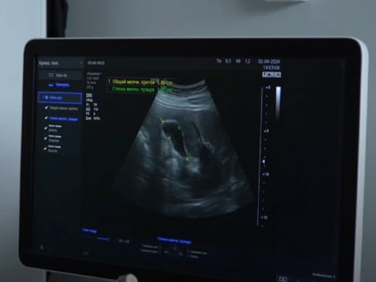 Новые цифровые УЗИ-аппараты вводятся в эксплуатацию в медицинских учреждениях Архангельской области