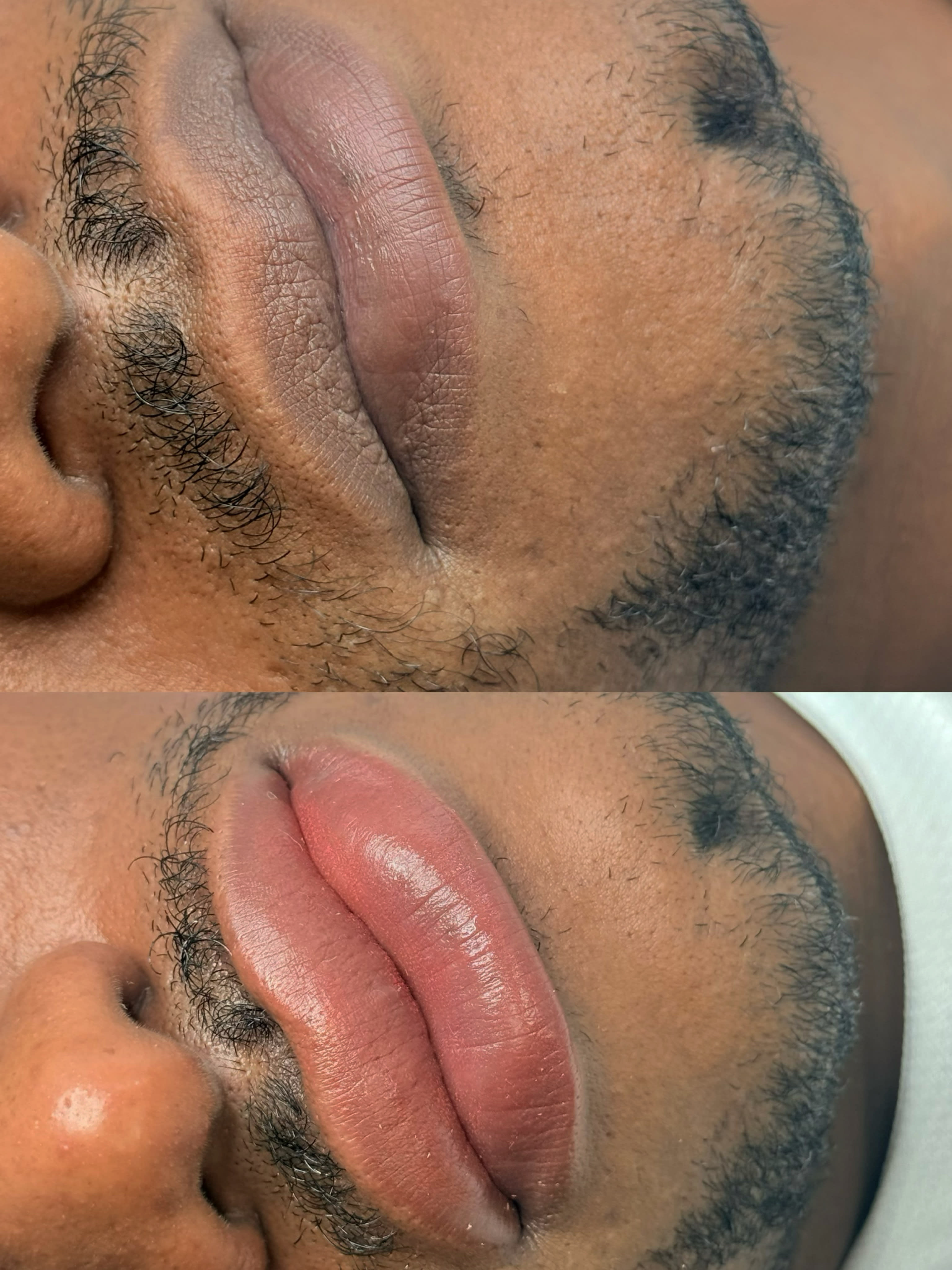 Neutralización de labios caballeros