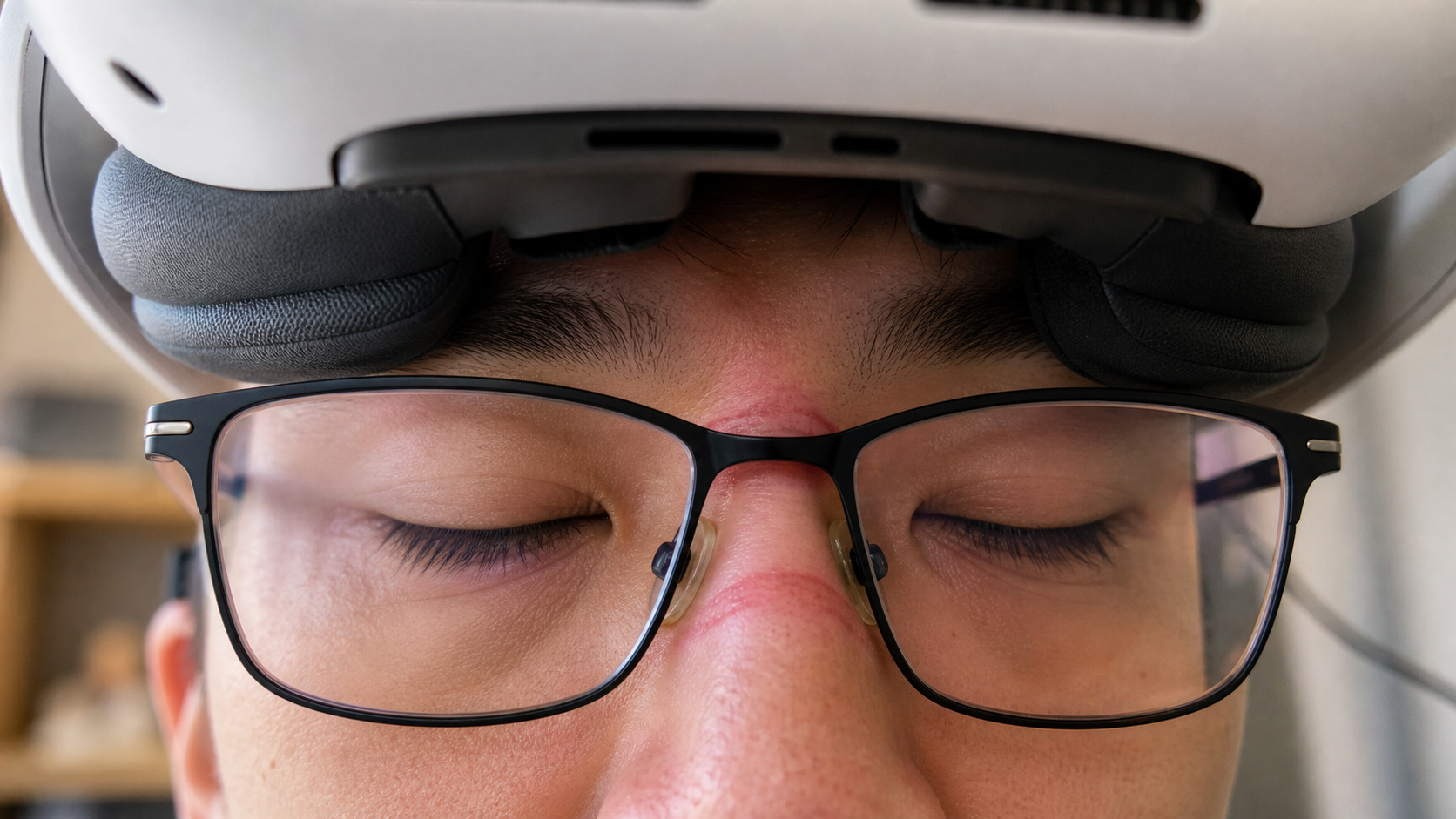 A close-up of a user's face showing pressure marks on their nose bridge from wearing glasses with a VR headset
