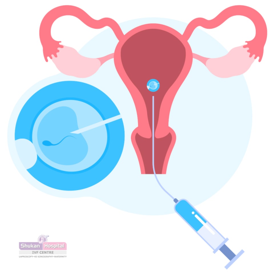 IVF Timeline | Kofinas Fertility, image size:960x960