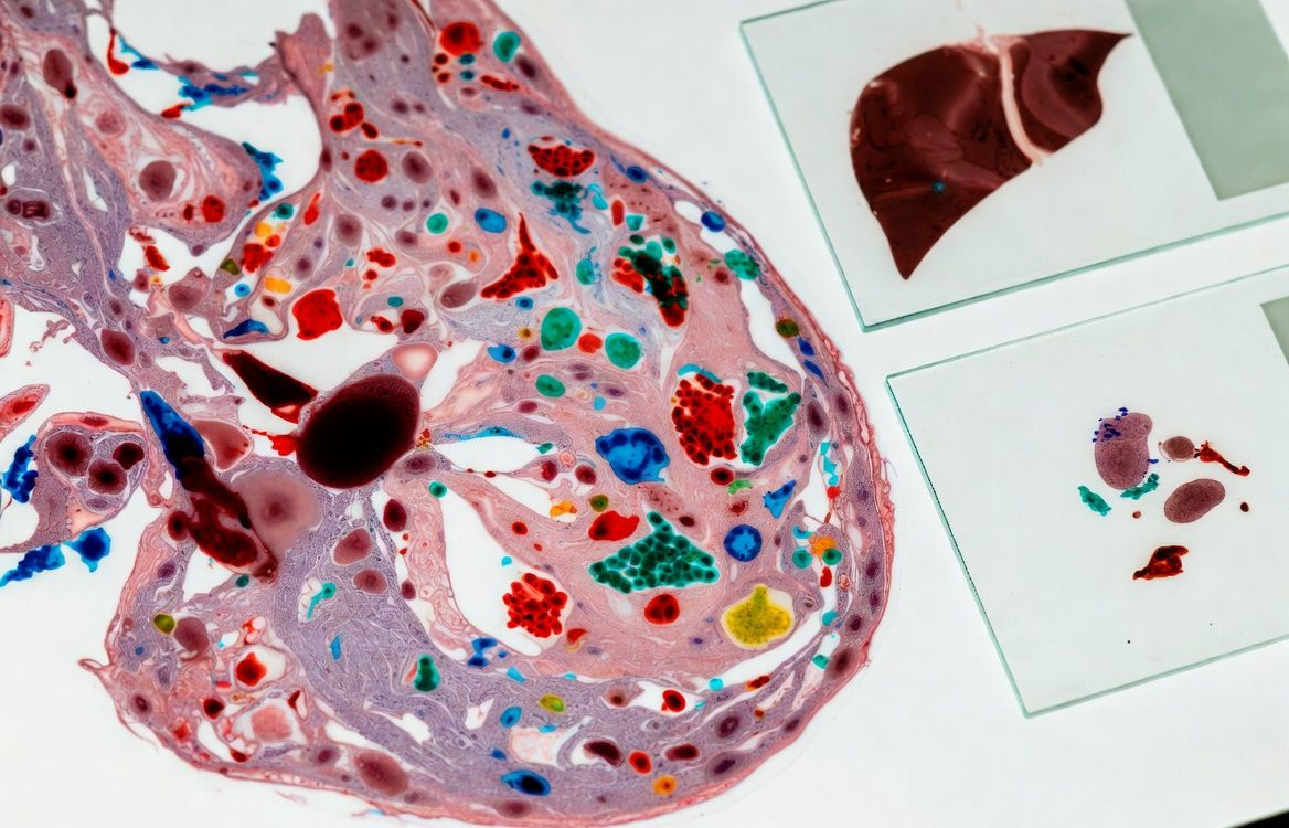 Smegenyse mikroplastiko kiekis per aštuonerius metus išaugo 50 procentų