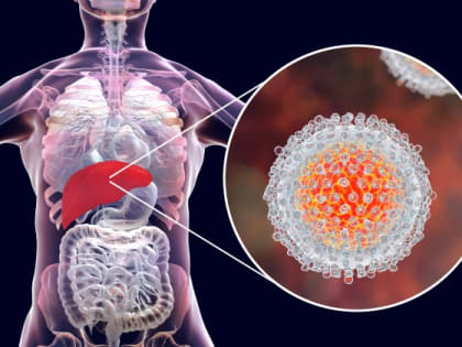 Гепатит С сокращает жизнь на четверть