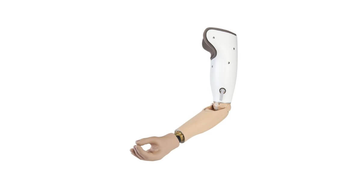 Above Elbow Prosthesis (Be- bionic)