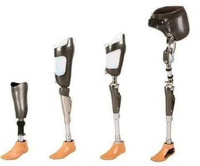 Through Knee Amputation