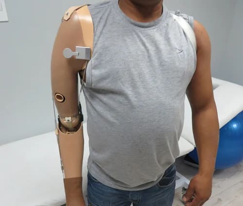 konuiyer-uparer-angser-mechanical-prosthetic-hat