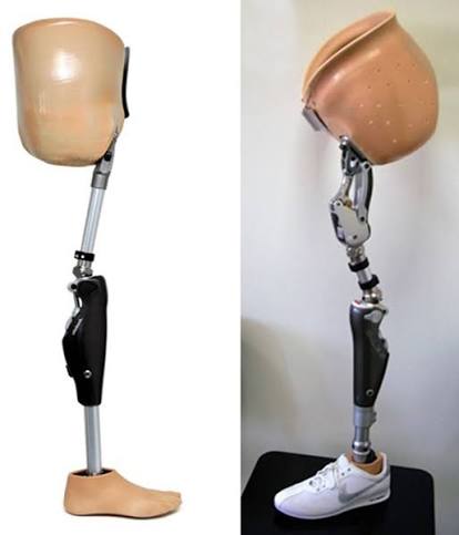 Hip Disarticulation Prosthesis (HD)
