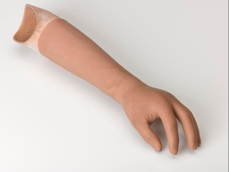 Below Elbow Prosthesis (Cosmetic)