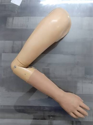 Above Elbow Prosthesis (Cosmetic)