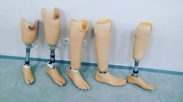 Symes & Ankle Disarticulation Prosthesis