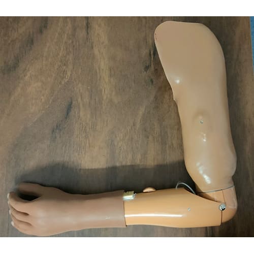myoelectric-above-elbow-prosthesis