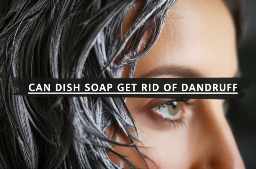 Can Dish Soap Get Rid Of Dandruff